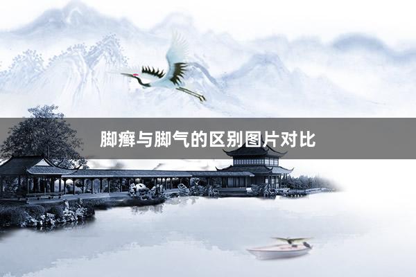 脚癣与脚气的区别图片对比